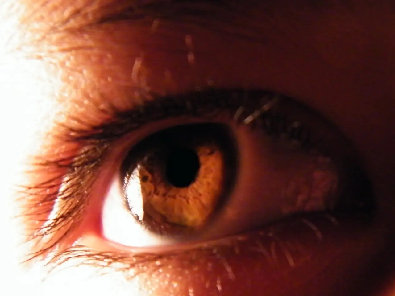 Eye Lid Eczema: Origins, Remedies, and Additional Information