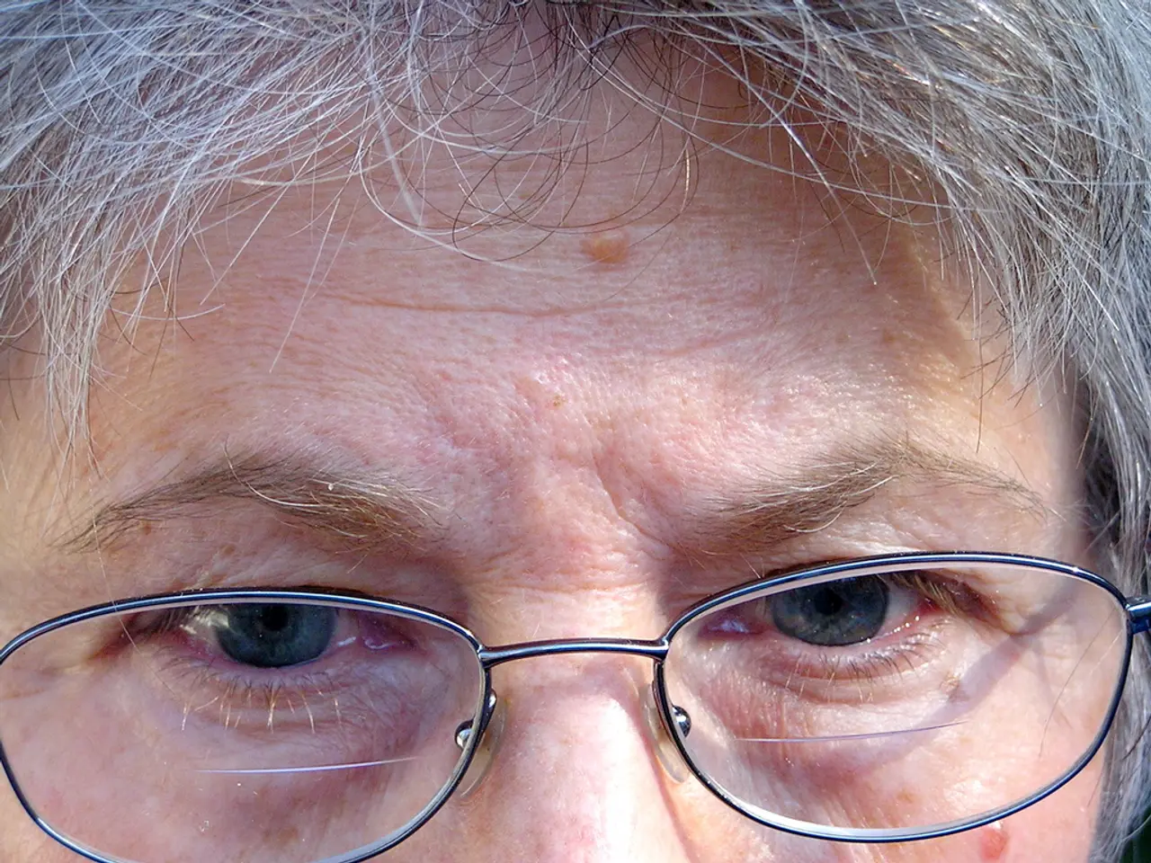 Top picks for multi-focal contact lenses