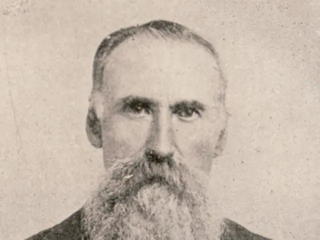 Prognosis, treatment strategies, and anticipating outcomes for Hairy Cell Leukemia