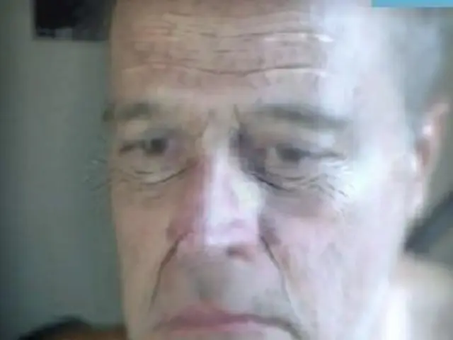 Overcoming Acne in Your 50s: A Handy Strategies Manual