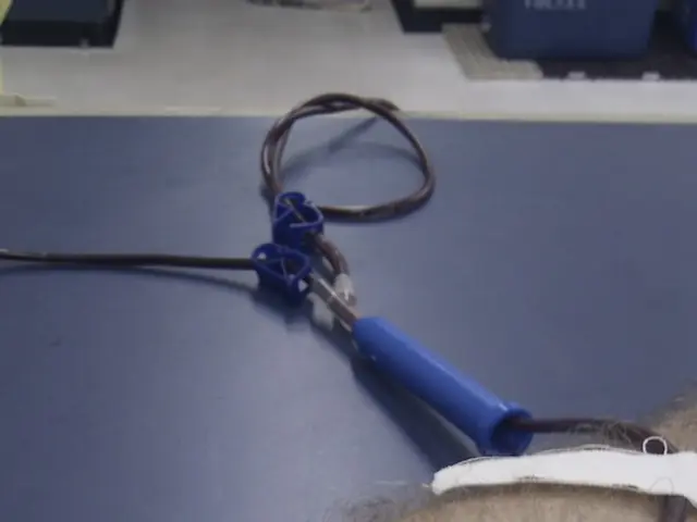 Understanding Kidney Filtration Process: Dialysis Explained