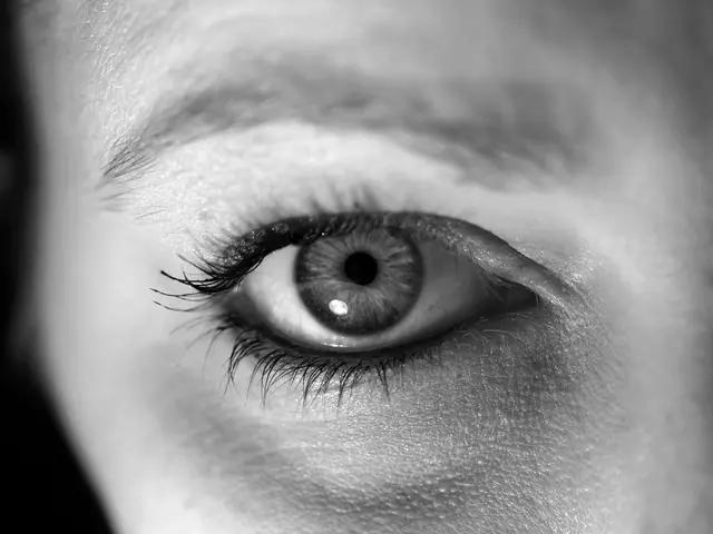 Practical Methods for Reducing Eye Wrinkles for Everlasting Attractiveness