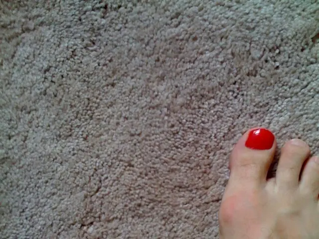 Arm Shingles: Recognizing Symptoms, Identifying Causes, Exploring Treatments, and Delving Deeper